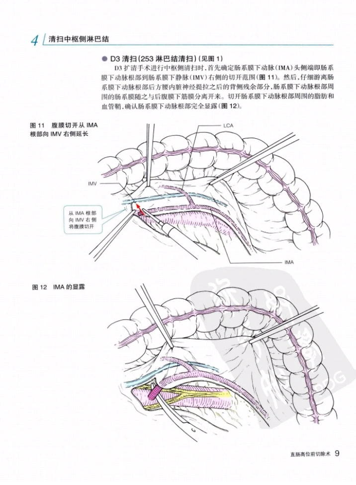 图片[3]-消化外科手术图解--直肠外科手术操作要领与技巧 扫描版PDF电子书下载