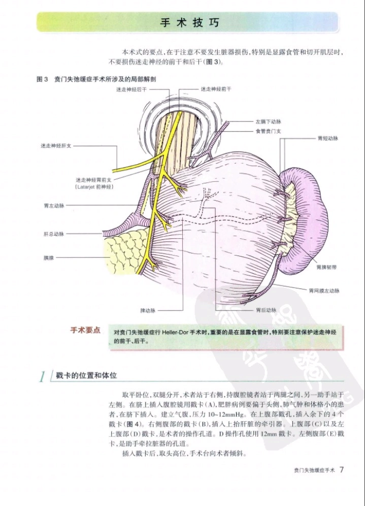 图片[3]-消化外科手术图解6--食管胃外科复杂手术操作要领与技巧 扫描版PDF 电子书下载