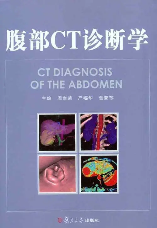图片[1]-腹部CT诊断学 周康荣,严福华,主编 2011年PDF扫描版医学电子书下载